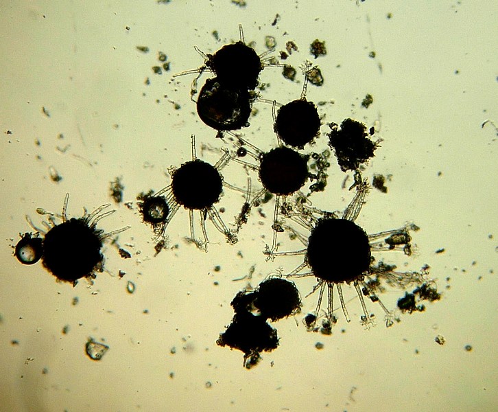 Cleistoteci di Microspahera alphitoides (mal bianco quercia)